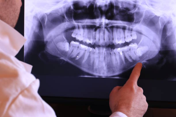 Best Emergency Dental Services for Seniors in Rock Hill, SC